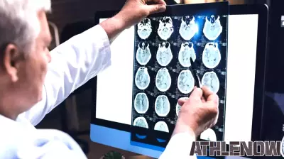 More concussions equal worse brain health 5 years after college sports